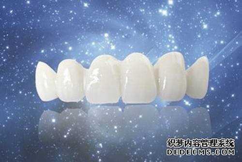 美容冠多少钱一颗