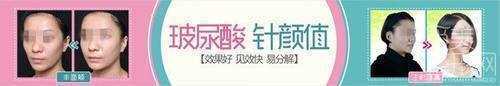 西安西京医院整形科打玻尿酸多少钱?