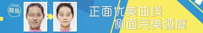 西京医院磨骨多少钱？怎么样？