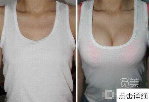 北京八大处整形隆胸好还是上海九院整形科好?