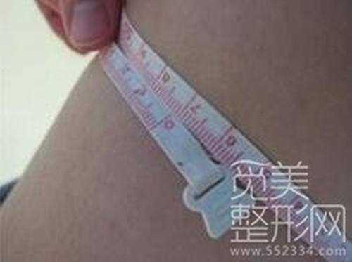 大腿吸脂术后2个月