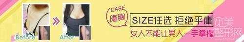 西安西京医院整容外科隆胸