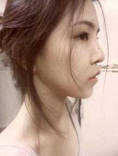 *+硅胶隆鼻+鼻翼软骨提升整形手术