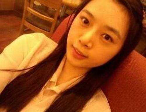【点击右方咨询窗口与专业整形*在线咨询】 全脸自体脂肪填充一个月后照片
