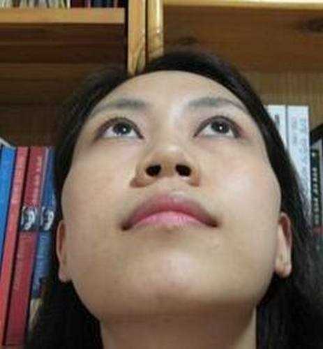 【点击右方咨询窗口与专业整形*在线交流】 隆鼻整形手术5个月后记