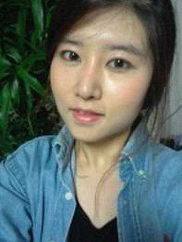 【有不了解的整形问题可以点击右方咨询窗口与觅美网专业*在线咨询】 硅胶隆鼻 自体软骨垫鼻尖 全切双眼皮