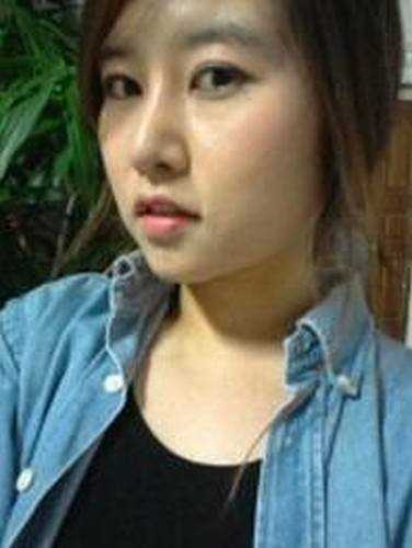 【有不了解的整形问题可以点击右方咨询窗口与觅美网专业*在线咨询】 硅胶隆鼻 自体软骨垫鼻尖 全切双眼皮