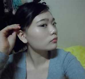 【点击右方咨询窗口与觅美网专业整形*在线咨询】 下颌角削骨+磨颧骨手术