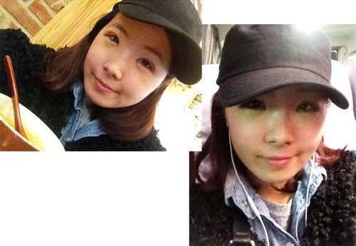 【点击右方咨询窗口与觅美网*设计适合您的项目】 韩式三点双眼皮+开眼角手术后日记
