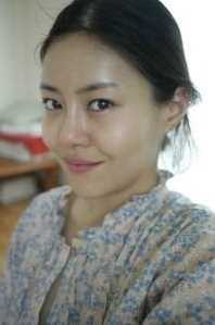 【觅美网专家在线交流-点击右方咨询窗口与专家交流】 硅胶隆鼻+脸部自体脂肪填充整形手术2个月后