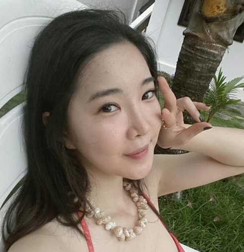 【点击右方咨询窗口觅美网为您免费预约东方和谐医院】 北京东方和谐双眼皮+面部自体脂肪填充案例