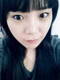 【点击右方咨询窗口觅美网为您免费提供专业的整形咨询】 硅胶隆鼻+开眼角+面部填充6个月后