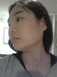 【点击页面上的咨询窗口与觅美网专业整形*在线交流】 颧骨降低手术+下颌角手术