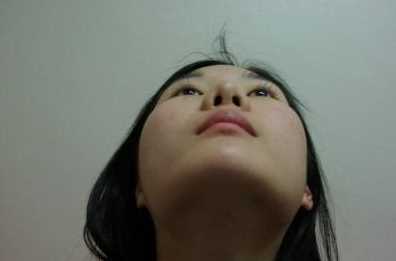【点击页面上的咨询窗口与觅美网专业整形*在线交流】 颧骨降低手术+下颌角手术