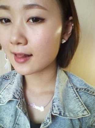 【点击咨询窗口获取更多整形案例以及讲解】 下颌角削骨和颧骨降低手术