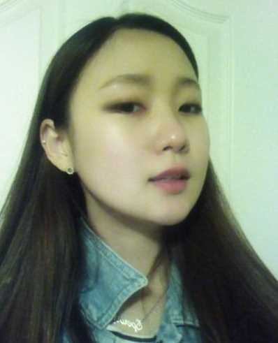 【点击咨询窗口获取更多整形案例以及讲解】 下颌角削骨和颧骨降低手术