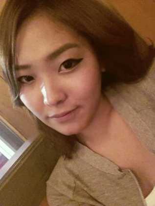 【点击哦页面上咨询窗口与觅美网*在线交流】 双眼皮修复手术案例图