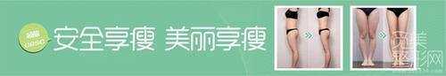 北京艺美整形医院抽脂吸脂多少钱？价格表