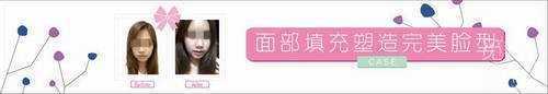 济南省立医院整形科丰额头多少钱？案例图