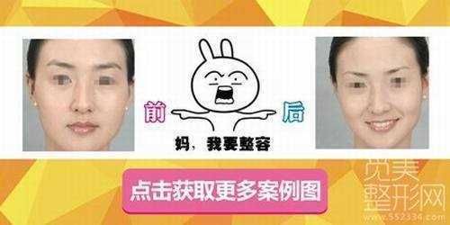 西京医院切眉价格表