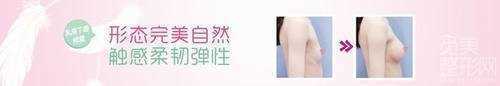西京医院乳房下垂矫正价格表