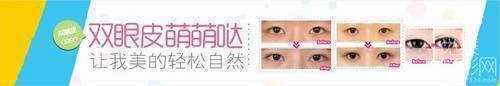 上海艺星整形双眼皮修复多少钱【价格表】