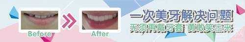 上海九院整形科牙齿矫正怎么样