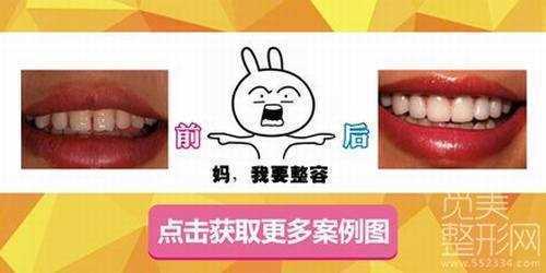 上海九院整形科牙齿矫正怎么样
