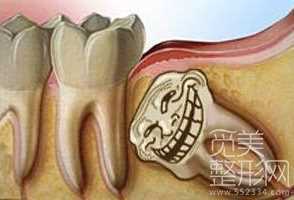 整形一些传言真的假的？【辟谣】