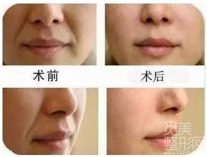 科普面部抗衰,尤为关键的几个部位