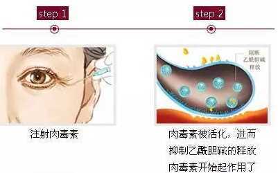 科普面部抗衰,尤为关键的几个部位