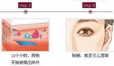 科普面部抗衰,尤为关键的几个部位