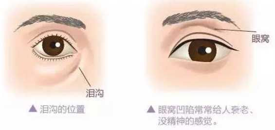 科普面部抗衰,尤为关键的几个部位