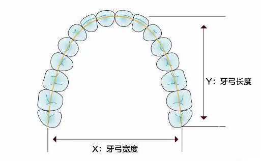 牙齿矫正为什么要拔牙?解答