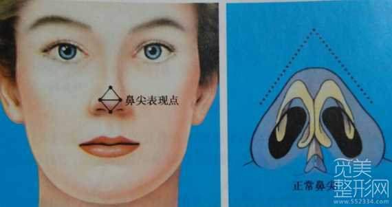 做鼻头鼻翼缩小注意哪些?怎么做?