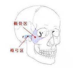 颧骨降低和颧弓内推有什么区别 介绍 整形价格表