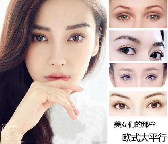 欧式大平行双眼皮如何做?怎样的适合自己