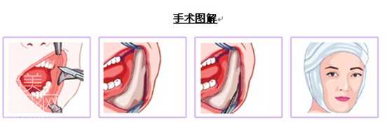 各项目整形价格表详细价格表