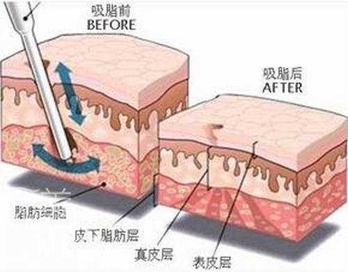 各项目整形价格表详细价格表