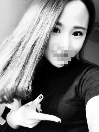 双眼皮,恢复过程没有增生哦