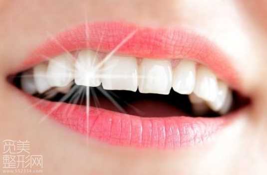 牙齿美白有副作用吗 *性吗 对假牙有*吗