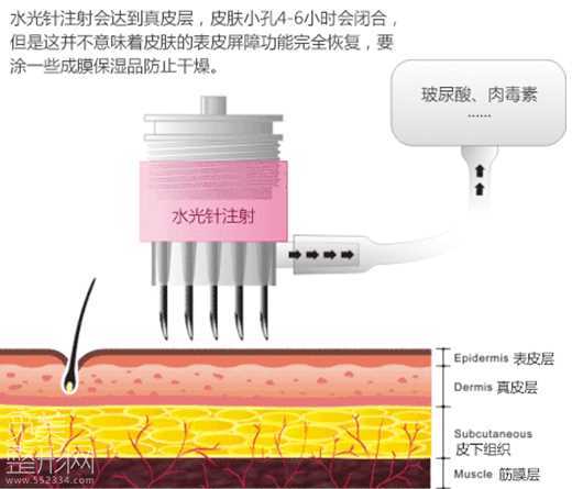水光补水介绍