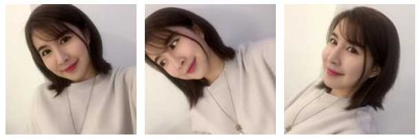 西京医院做的下颌角整形手术看看怎么样？好看