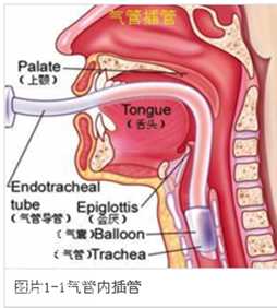 下颌角削骨面部整形麻醉方式