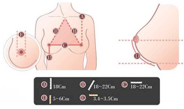 乳房的基本形态 什么样的胸才是正常的样子