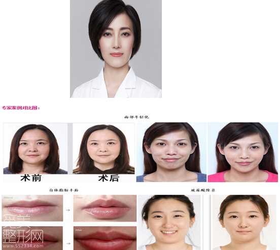 医生介绍 成都星尚美整形医院