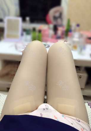 ¥35200做的大腿吸脂在成都艾米
