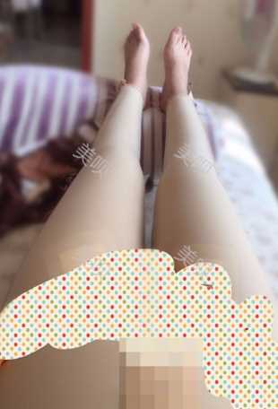 ¥35200做的大腿吸脂在成都艾米