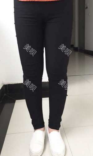 ¥35200做的大腿吸脂在成都艾米