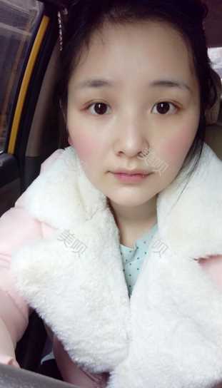 ¥3800双眼皮长沙美之峰